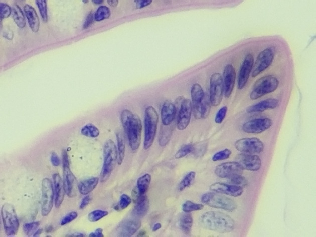 Simple Columnar Epithelium Slides - Simple Columnar Epithelium 03 400X